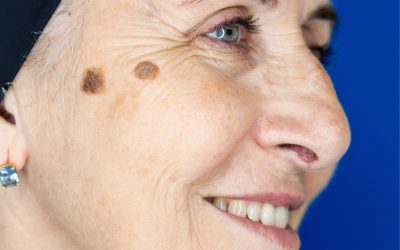 Día mundial del cáncer