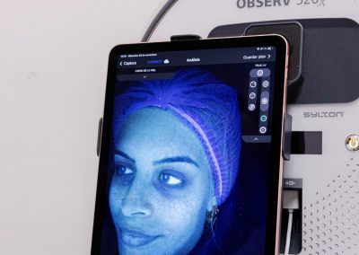 Análisis cutáneo avanzado con tecnología Observ 520x para diagnóstico personalizado en medicina estética basado en criterio médico y naturalidad facial.