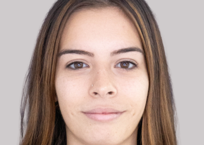 Paciente durante valoración facial personalizada en medicina estética para diagnóstico cutáneo individualizado y planificación de tratamientos basados en criterio médico.