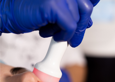Aplicador de electroporación de AquaPure sobre el contorno de los labios.
